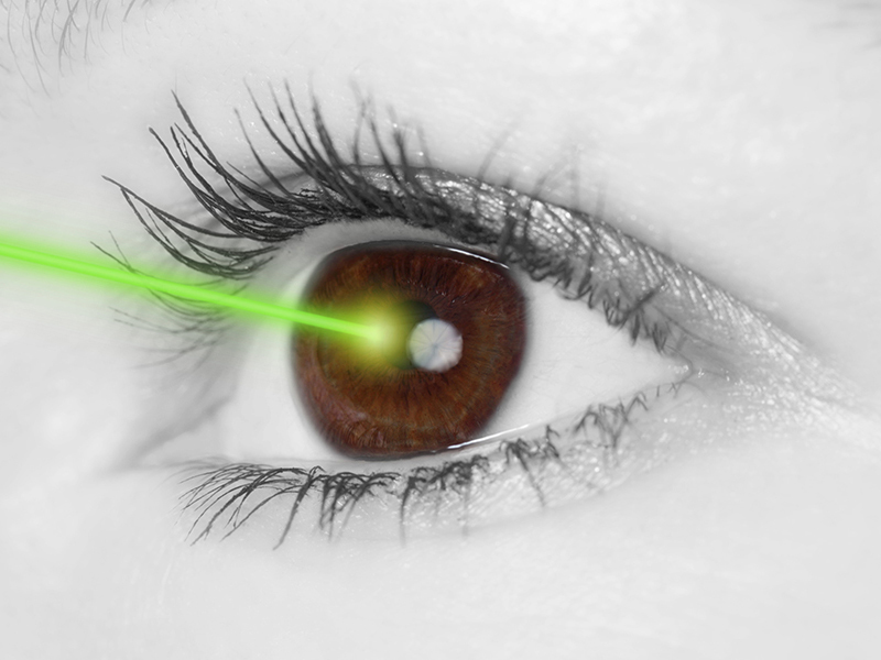 La chirurgie au laser peut corriger certaines déficiences visuelles